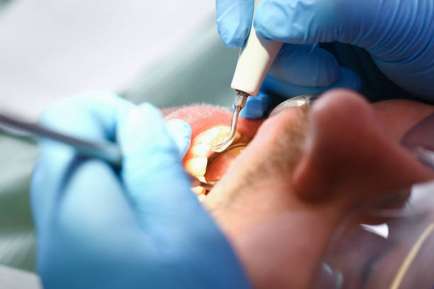 Best Emergency Broken Tooth Repair in Fox Farm College, WY
