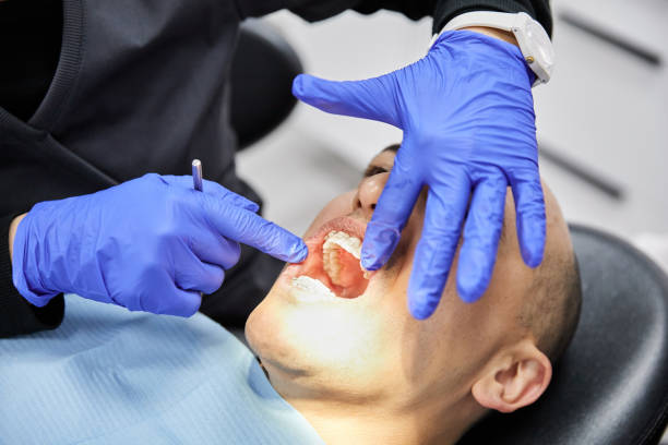 Best Emergency Treatment for Toothache in Fox Farm College, WY